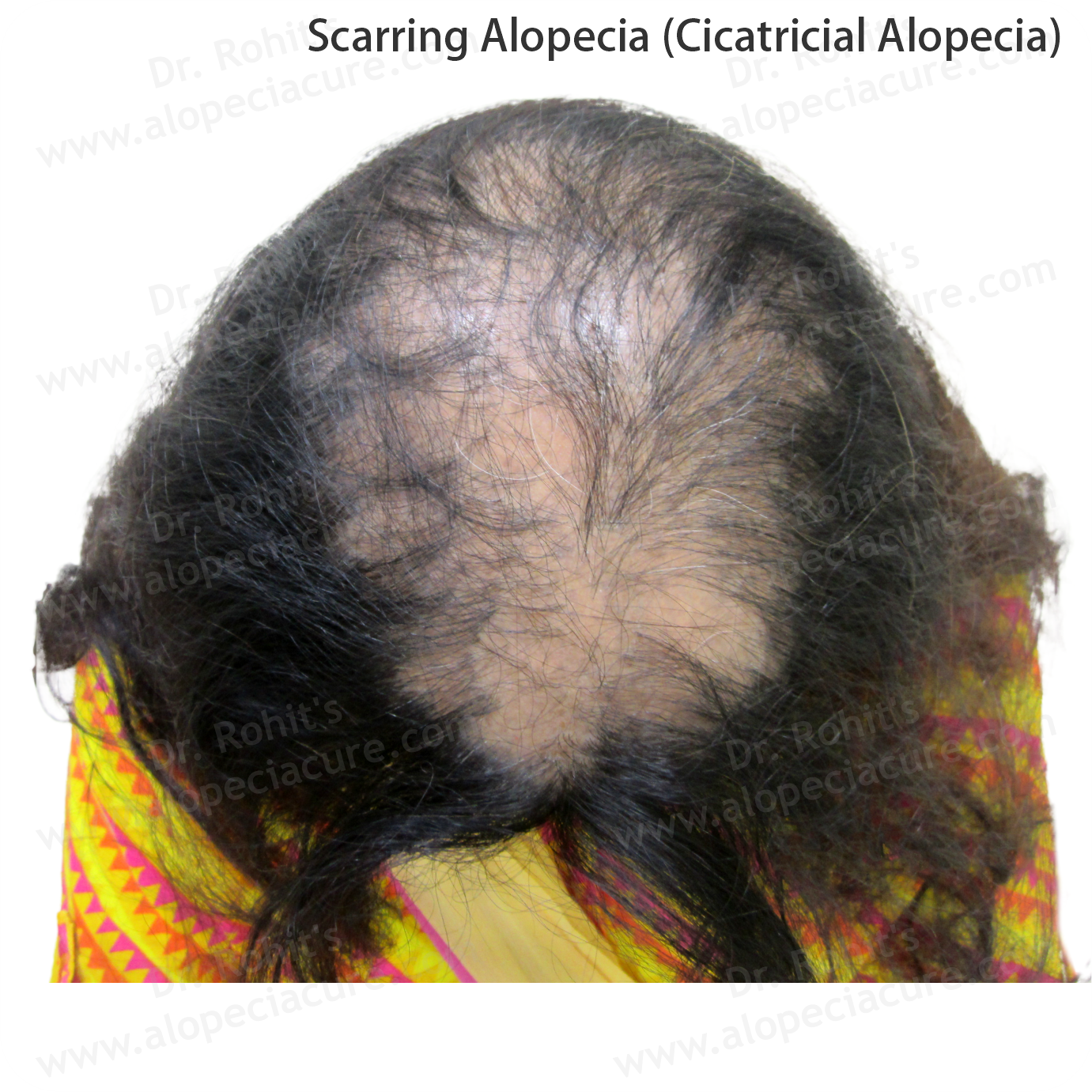 Clinical Hair Treatment